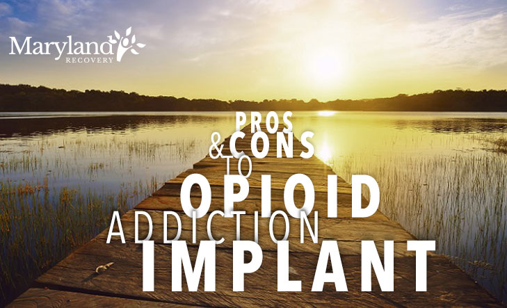 The Pros And Cons To The Opioid Addiction Implant