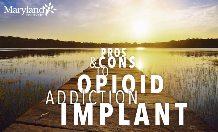 Pros And Cons To Opioid Addiction Implant-MarylandRecovery