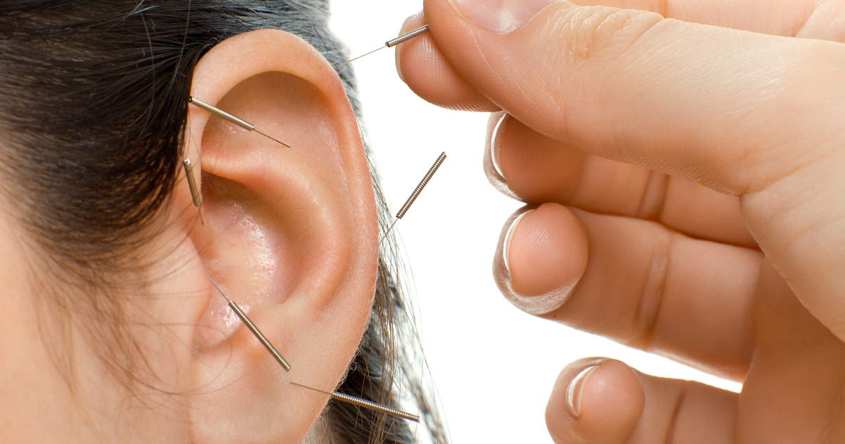 Acupuncture and the Ear