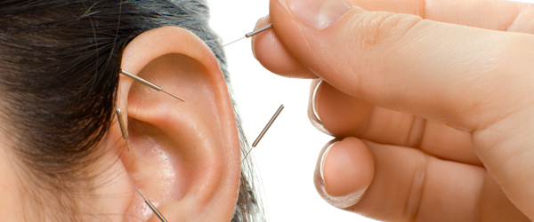Acupuncture